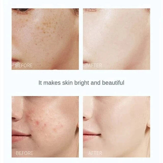 Glow and White Korean Whitening Cream