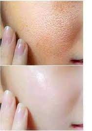 Glow and White Korean Whitening Cream