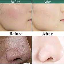 Glow and White Korean Whitening Cream